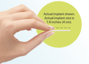 Birth Control Arm Implant Nexplanon