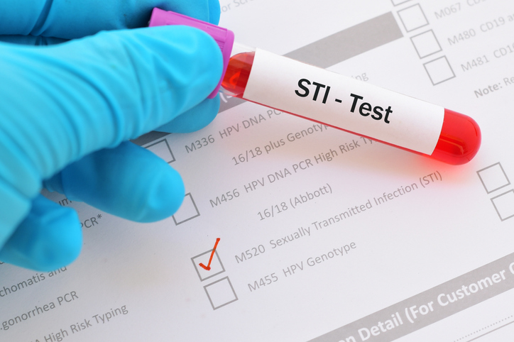 STD check los angeles 