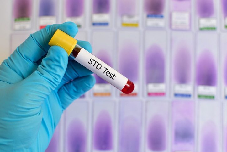 std screening los angeles