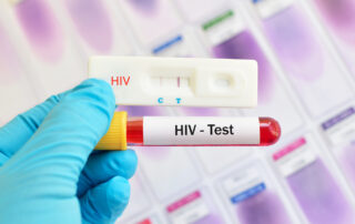 where to get free std testing