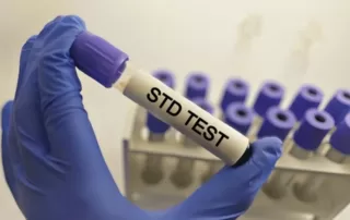 Everything You Must Know About STD Testing: Why It's Essential and What to Expect from it